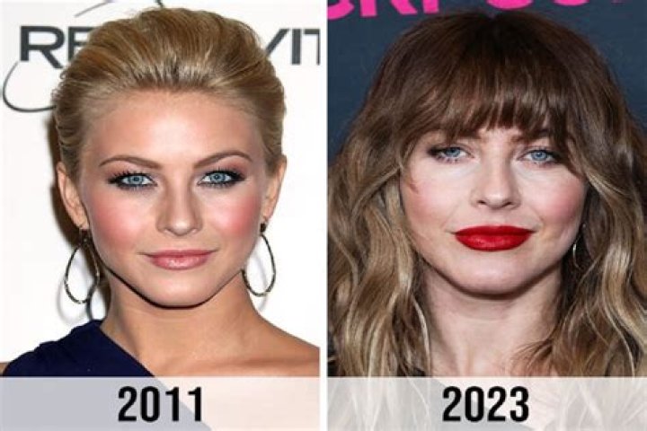 Unveiling The Truth: Julianne Hough Surgery Insights