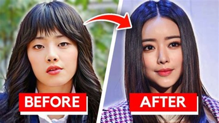 Korean Actor And Actress Plastic Surgery: Unveiling The Transformation
