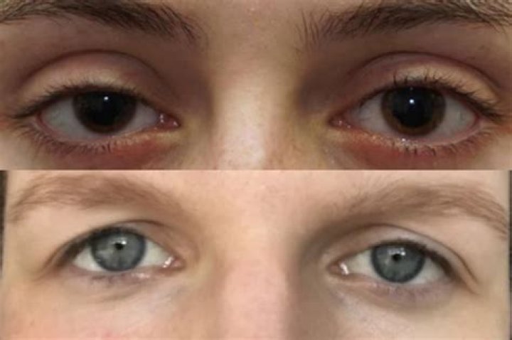 Unveiling The Mystique Of Prey Eyes: Nature's Intriguing Adaptation