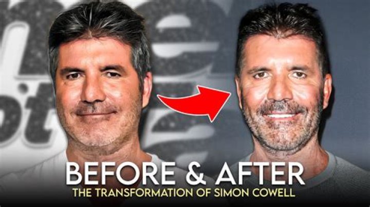 Exploring Simon Cowell's Son Condition: A Father's Journey